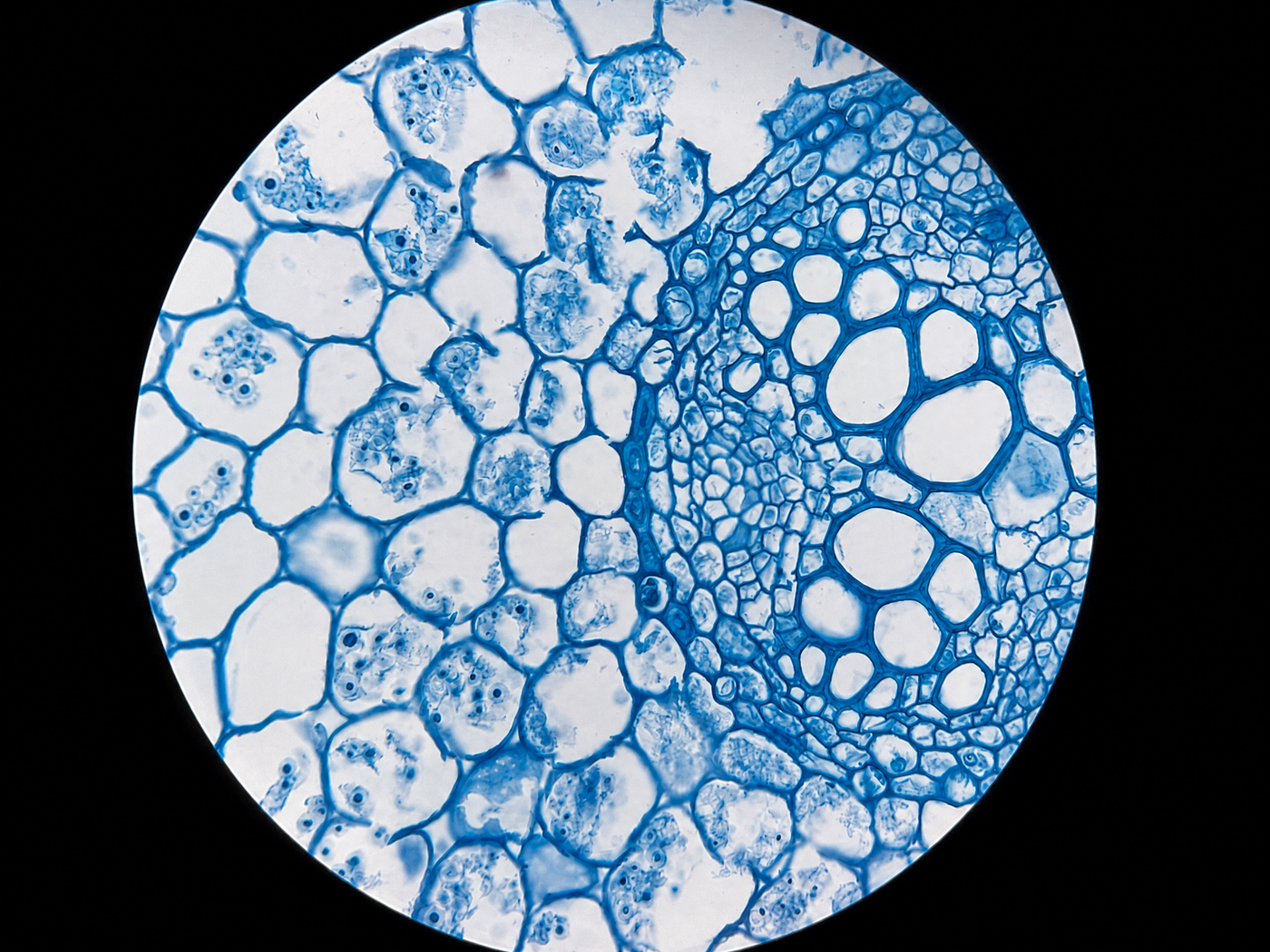 Where formulation meets the follicle